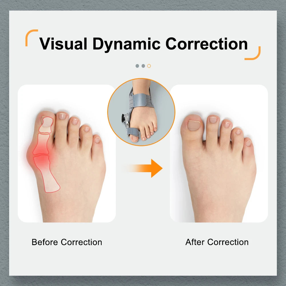 Lando™ Hallux Correct | Beleben Sie Ihre Füße und Schritte!